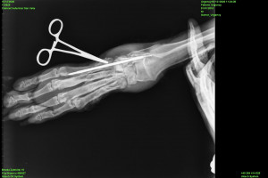 Radiografia_INTECH (1).jpg