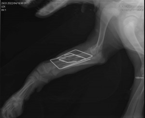 Radiografii efectuate dupa intervenția chirurgicala unde s-a decis osteosinteza externă, remediera fracturii cu fixatori externi.