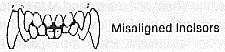ALINIERE INCISIVI.gif